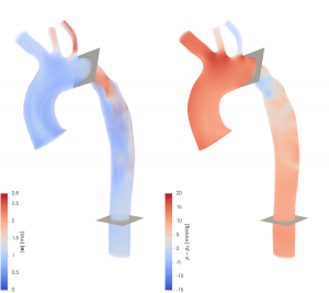 Simulation of aortic flow